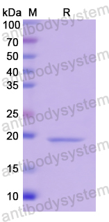 Recombinant Human WNT11 Protein, N-His