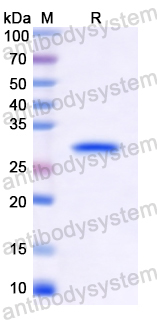 Recombinant Human CHEK2 Protein, N-His