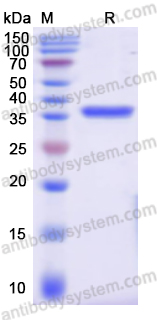 Recombinant Human LDHA Protein, N-His