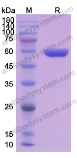 Recombinant Human ALDH1A1 Protein, N-His