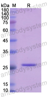 Recombinant Human GLUD1 Protein, N-His