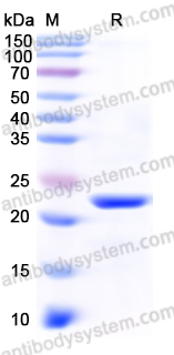 Recombinant Human DHFR Protein, N-His