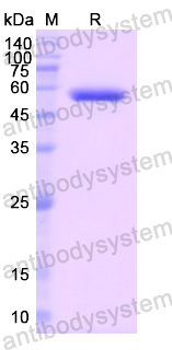 Recombinant Human GSR Protein, N-His