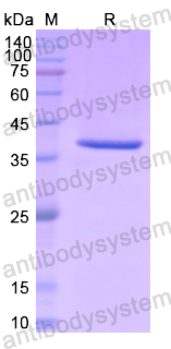 Recombinant Human PAH Protein, N-His