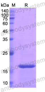 Recombinant Human SOD1 Protein, N-His