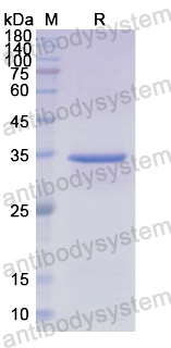 Recombinant Human CP Protein, N-His