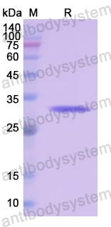 Recombinant Human OTC Protein, N-His