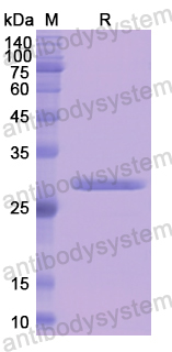 Recombinant Human F13A1 Protein, N-His