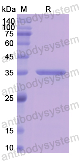 Recombinant Human PNP Protein, N-His