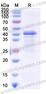 Recombinant Human GOT2 Protein, N-His