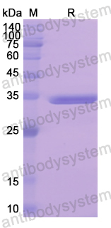 Recombinant Human EGFR Protein, N-His