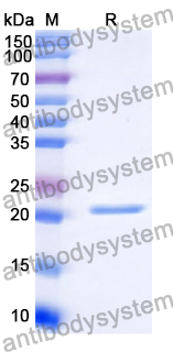 Recombinant Human EGFR/ERBB1/HER1 Protein, N-His