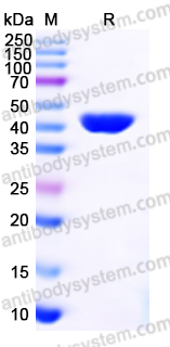 Recombinant Human PGK1 Protein, N-His