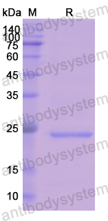 Recombinant Human AK1 Protein, N-His