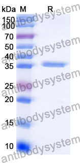 Recombinant Human F2/Prothrombin Protein, N-His