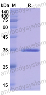 Recombinant Human PLG Protein, N-His