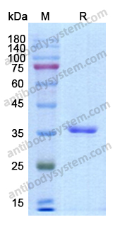 Recombinant Human F12 Protein, N-His