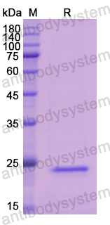 Recombinant Human CFB Protein, N-His