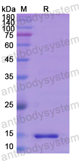 Recombinant Human REN Protein, N-His