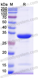 Recombinant Human ADA Protein, N-His