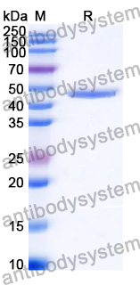 Recombinant Human ADA/Adenosine deaminase Protein, N-His-SUMO