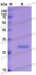 Recombinant Human CA1 Protein, N-His