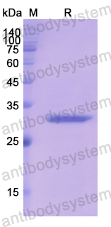 Recombinant Human CA2 Protein, N-His