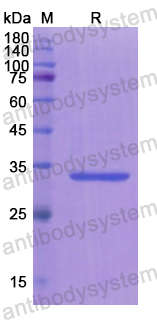 Recombinant Human ASS1 Protein, N-His