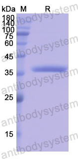 Recombinant Human OAS1 Protein, N-GST