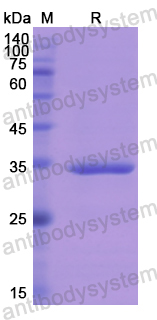 Recombinant Human SPINK1 Protein, N-GST