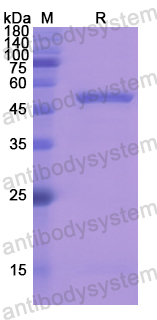 Recombinant Human SERPINC1 Protein, N-His