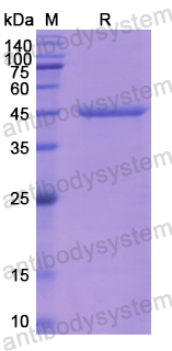 Recombinant Human a1AT/Serpin A1/SERPINA1 Protein, N-His