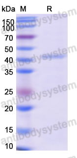 Recombinant Human SERPINA3 Protein, N-GST