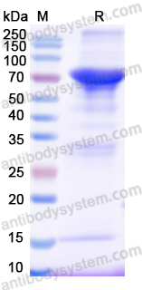 Recombinant Human AGT Protein, N-GST