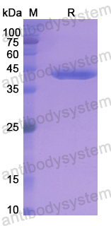 Recombinant Human C3 Protein, N-His