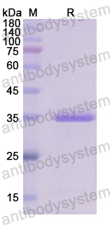 Recombinant Human C5 Protein, N-GST