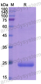 Recombinant Human TIMP1 Protein, N-His