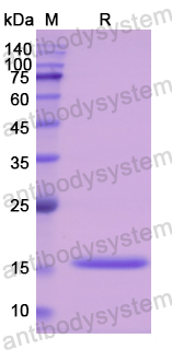 Recombinant Human CST3 Protein, C-His