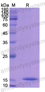 Recombinant Human CST4 Protein, N-His