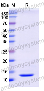 Recombinant Human CSTA Protein, N-His