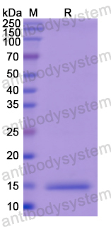 Recombinant Human KNG1 Protein, N-His