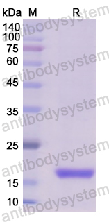 Recombinant Human KRAS Protein, N-His