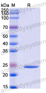 Recombinant Human KRAS/K-Ras 2 Protein, C-His-Avi