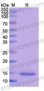 Recombinant Human PDGFB Protein, N-His