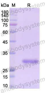 Recombinant Human LDLR Protein, N-His