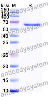 Recombinant Human LDLR Protein, C-His