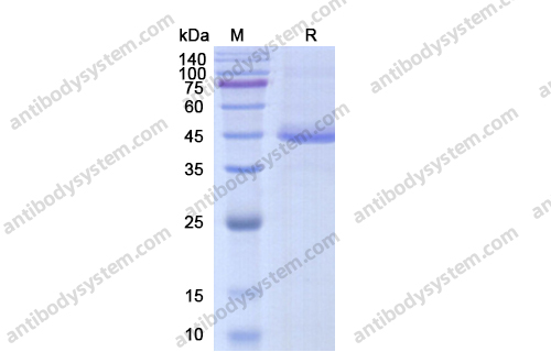 Recombinant Human TGFB1/TGF-beta-1 Protein, N-His