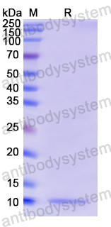 Recombinant Human GNRH1 Protein, N-His