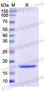 Recombinant Human AVP Protein, N-His