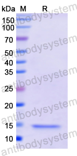 Recombinant Human FSHB Protein, N-His